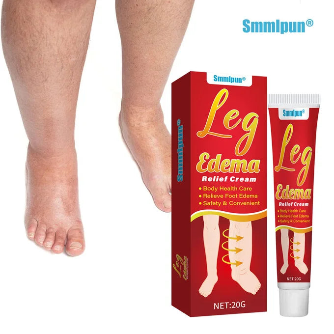 Sumifun Leg Edema Relief Cream